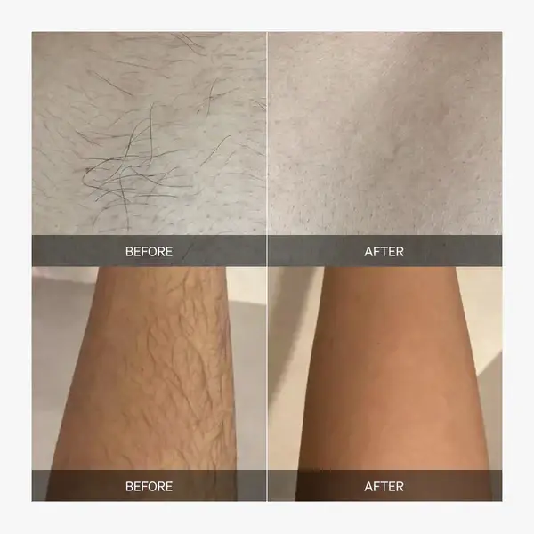 SmoothBeam - Full-Body Smoothness, Zero Irritation