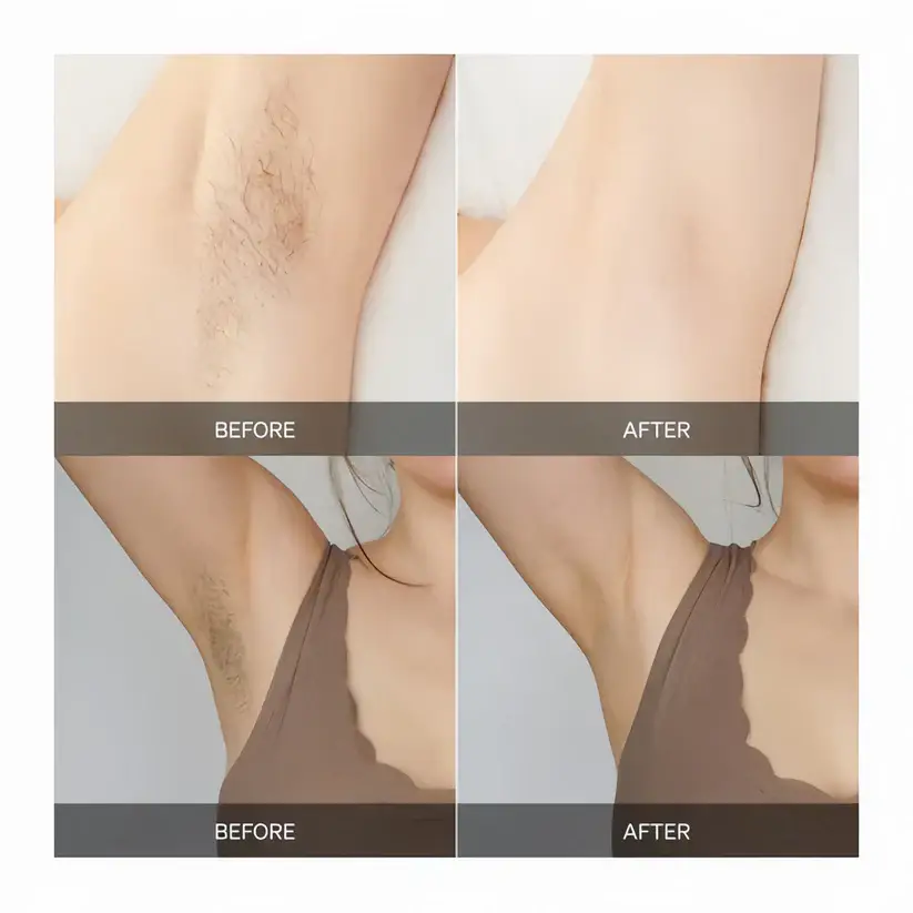 SmoothBeam - Full-Body Smoothness, Zero Irritation