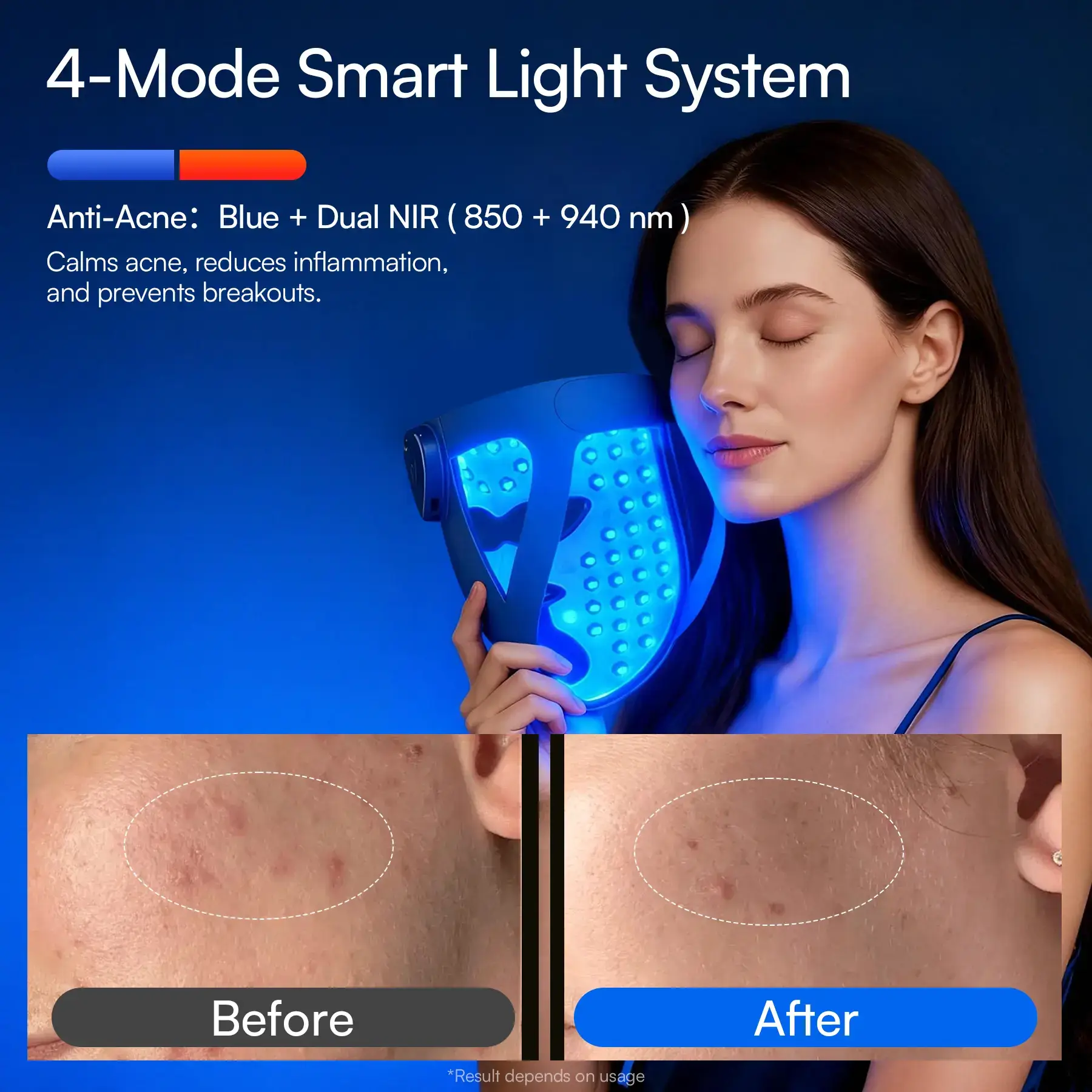 4D LED Light Therapy Mask, Dual NIR 940 + 850 nm Deep Penetration, Skin Repair & Lift, Jawline Firming with Cooling Therapy, Wireless Comfort