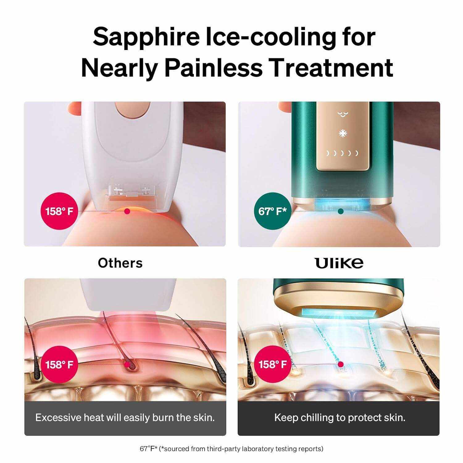 Ulike Laser Hair Removal for Women and Men, Air+ IPL Hair Removal Device with Sapphire Ice-Cooling Technology for Nearly Painless Result, Safe&Long-Lasting for Reducing in Hair Growth for Body & Face