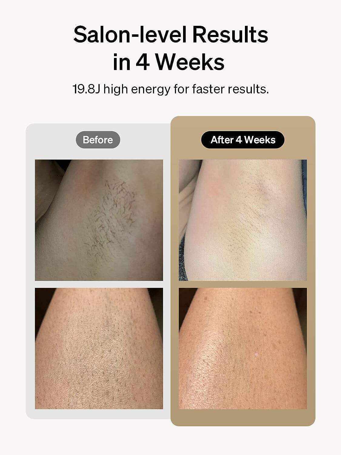 Ulike Laser Hair Removal for Women and Men, Air+ IPL Hair Removal Device with Sapphire Ice-Cooling Technology for Nearly Painless Result, Safe&Long-Lasting for Reducing in Hair Growth for Body & Face