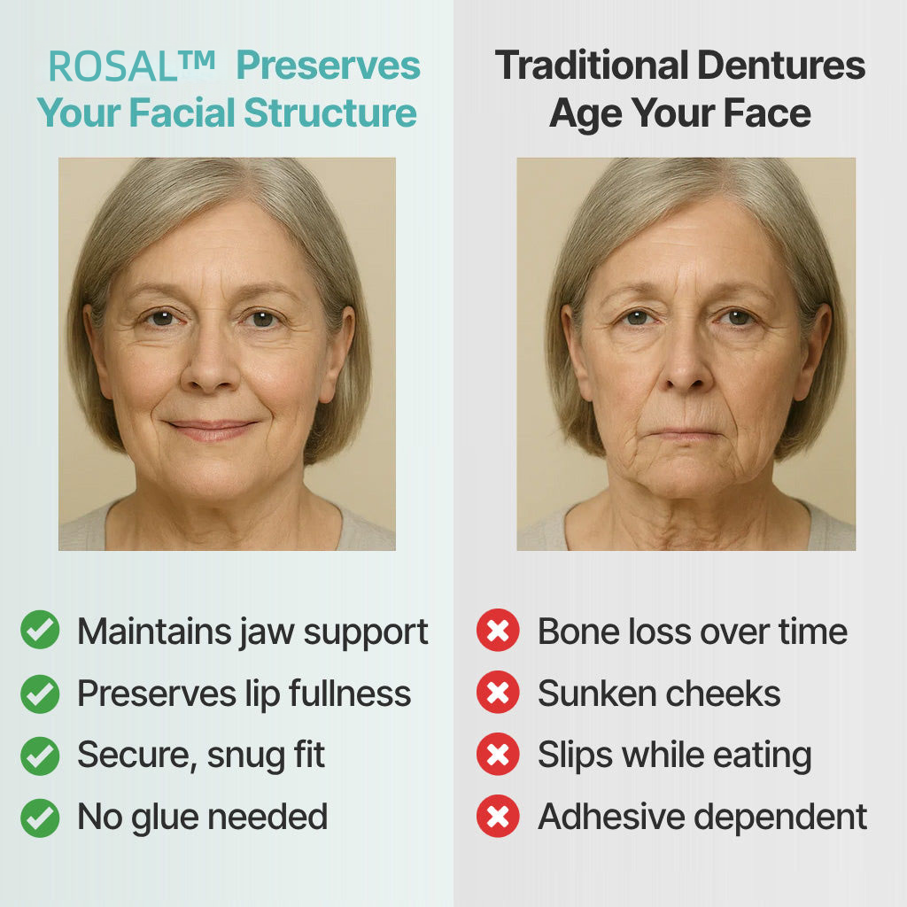 🌎Ends Today: 70% OFF! ROSAL™ Custom-Fit Full Functional DenturesMake you more confident